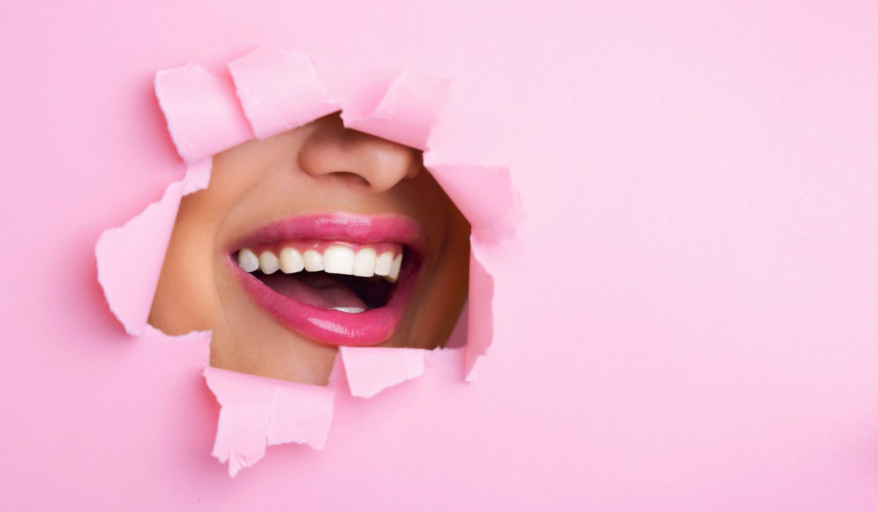 Beneficios blanqueamiento dental