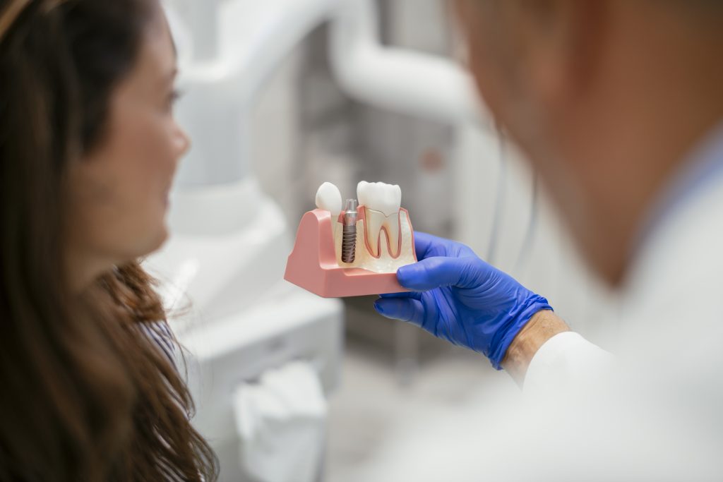 implantes dentales