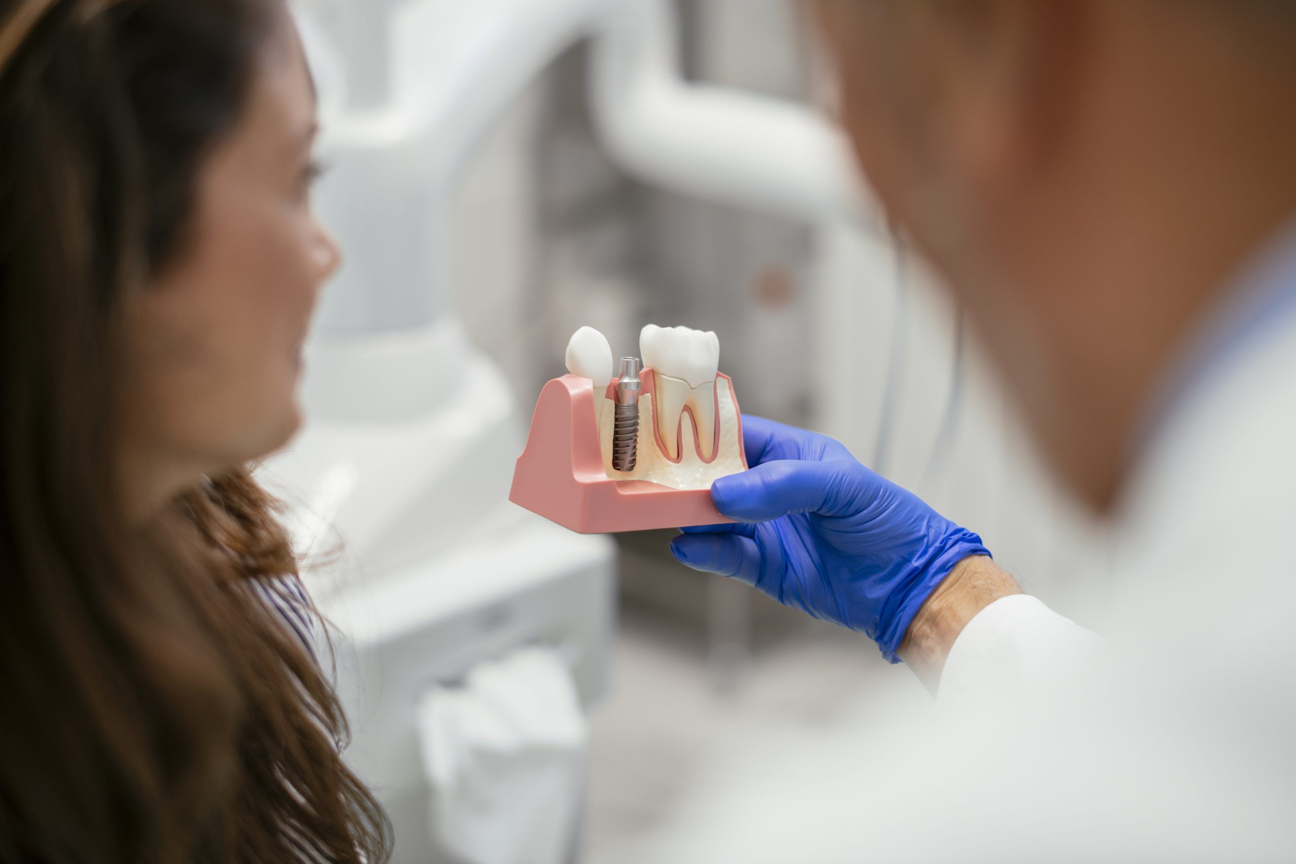 implantes dentales